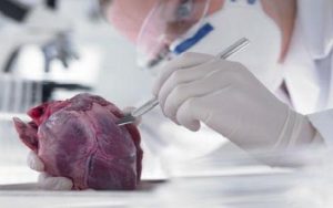 Arrhythmias Heart Disease Harmful Effects | Heart Disease Types 2 Heart Disease Treatment
