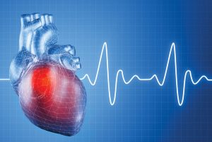 Myocardial Infarction Symptoms | National Guideline 3 High Cholesterol Level