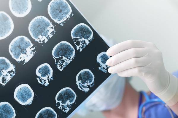 Traumatic Stress May Alter Boys’ and Girls’ Brains Differently