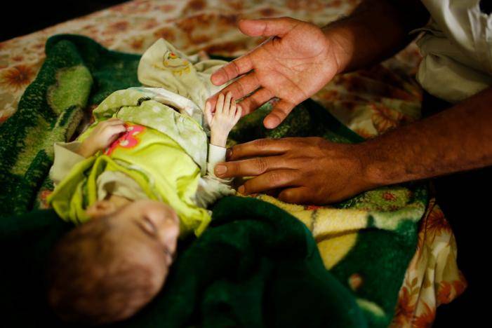 Babies Starve As War Grinds On In Mosul