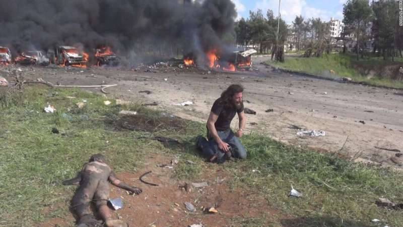 Syria photographer takes action instead of pictures, picks up injured boy