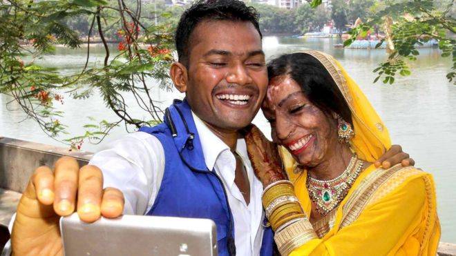 Indian acid-attack bride finds love from a wrong number