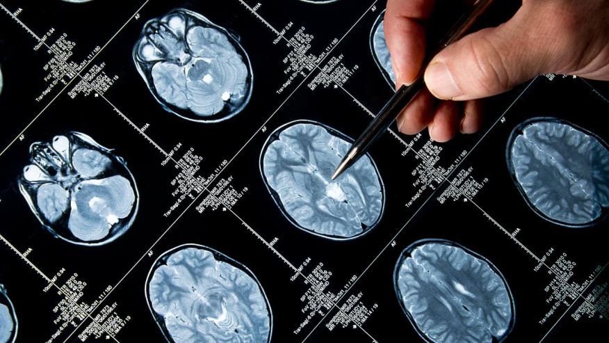 How to make your brain younger