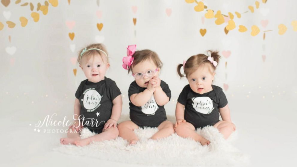 3 baby girls born in 3 days with 3 heart surgeries celebrate birthday milestone