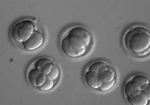 First human embryo editing experiment in U.S. repairs gene for heart condition
