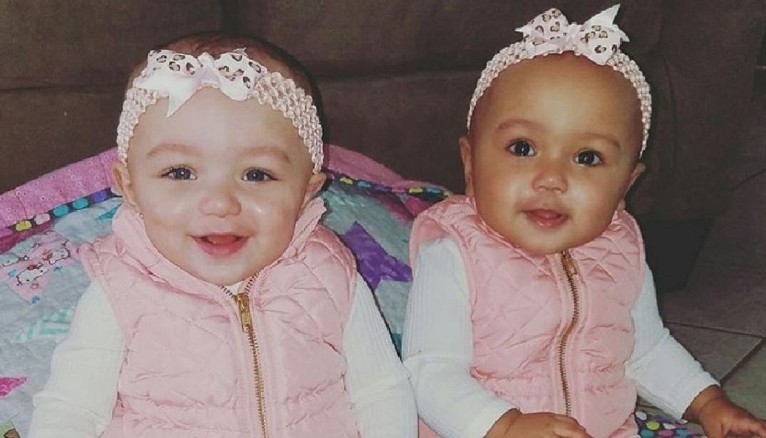 These twin baby girls have different skin colors