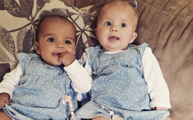 These twin baby girls have different skin colors