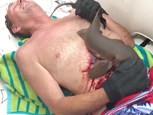 Shocking footage shows the moment a shark clamps on to swimmer’s stomach