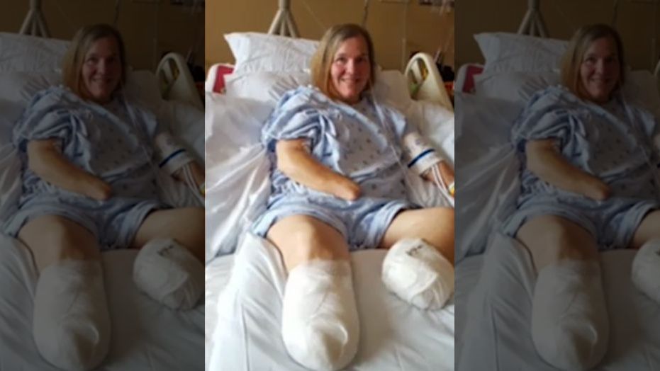 Woman loses both hands, legs after sepsis battle