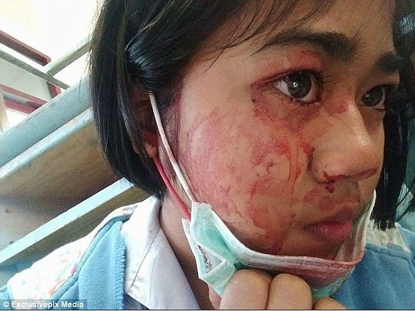 The woman who sweats blood from her palms and her face
