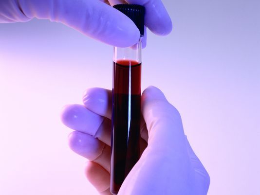 Most boomers infected with liver-damaging hepatitis C virus do not know it