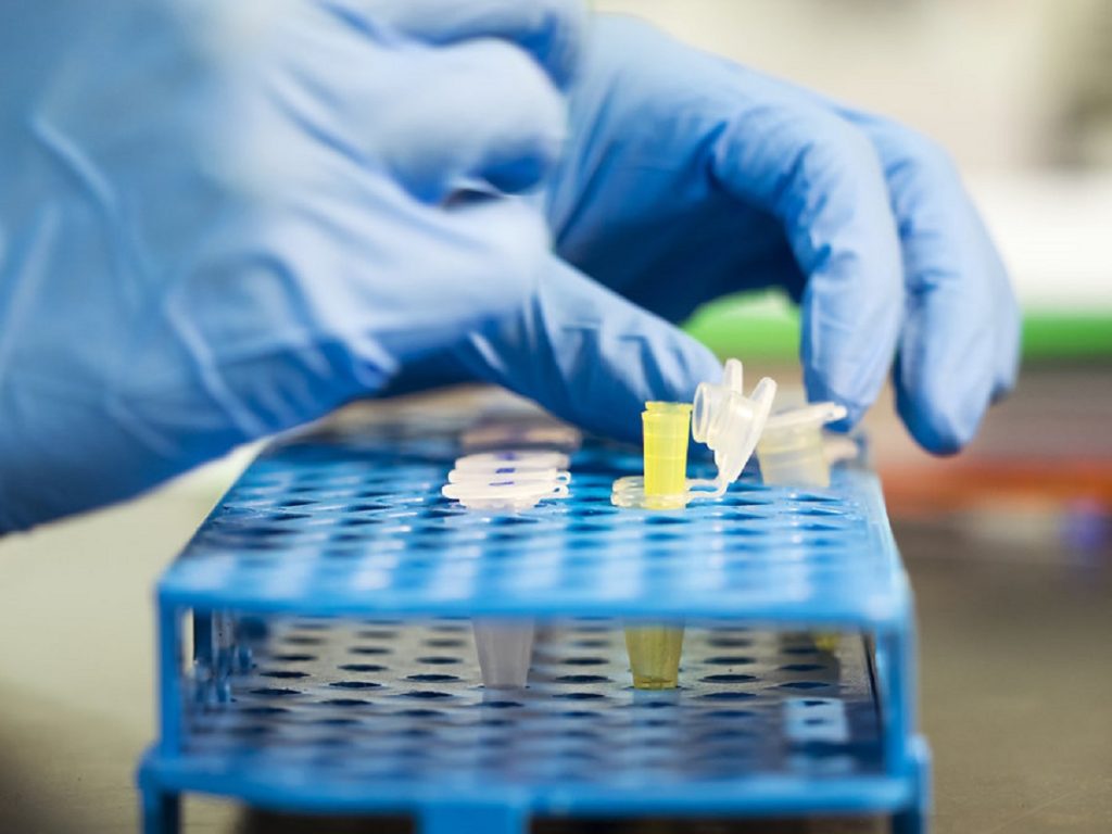 DNA Test Reveals Fertility Doctor Used His Own Sperm To Impregnate Patient