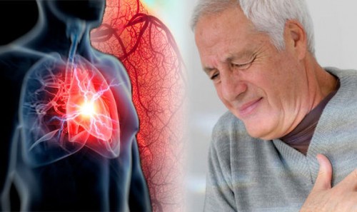 Heart Disease And Leg Pain